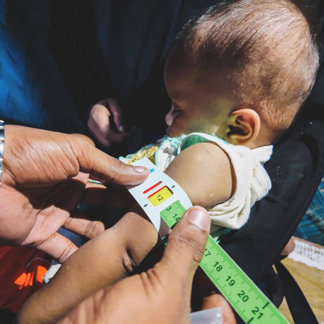 A health worker measures a young child&rsquo;s arm with MUAC tape while the child is held by her mother. The tape shows yellow, indicating moderate acute malnutrition.